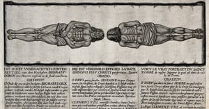 A German engraving of the man wrapped in the Shroud of Turin.