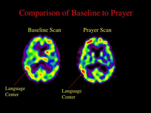 brain scan 1