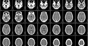 graphic depictions of human brains